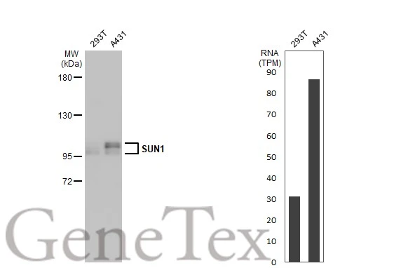 Various whole cell extracts (30 μg) were separated by 5% SDS-PAGE, and the membrane was blotted with SUN1 antibody [HL1947] (GTX637784) diluted at 1:1000. The HRP-conjugated anti-rabbit IgG antibody (GTX213110-01) was used to detect the primary antibody. Corresponding RNA expression data for the same cell lines are based on Human Protein Atlas program.