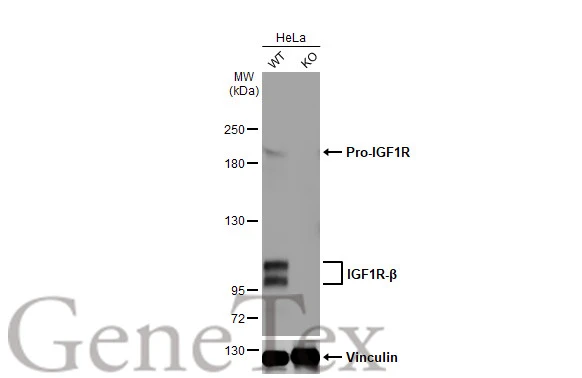 Wild-type (WT) and IGF1R knockout (KO) HeLa cell extracts (30 μg) were separated by 5% SDS-PAGE, and the membrane was blotted with IGF1R beta antibody [HL1958] (GTX637795) diluted at 1:1000. The HRP-conjugated anti-rabbit IgG antibody (GTX213110-01) was used to detect the primary antibody.
