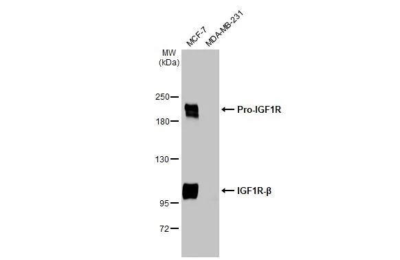 IGF1R beta antibody [HL1958]