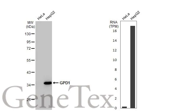 Various whole cell extracts (30 μg) were separated by 10% SDS-PAGE, and the membrane was blotted with GPD1 antibody [HL1959] (GTX637796) diluted at 1:1000. The HRP-conjugated anti-rabbit IgG antibody (GTX213110-01) was used to detect the primary antibody. Corresponding RNA expression data for the same cell lines are based on Human Protein Atlas program.