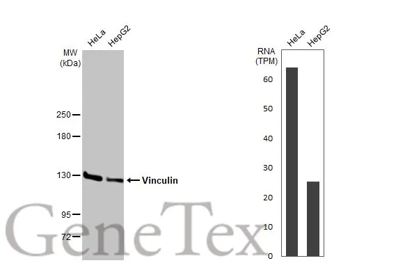 Various whole cell extracts (30 μg) were separated by 5% SDS-PAGE, and the membrane was blotted with Vinculin antibody [HL1964] (GTX637857) diluted at 1:1000. The HRP-conjugated anti-rabbit IgG antibody (GTX213110-01) was used to detect the primary antibody. Corresponding RNA expression data for the same cell lines are based on Human Protein Atlas program.