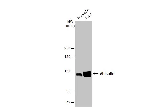 Various whole cell extracts (30 μg) were separated by 5% SDS-PAGE, and the membrane was blotted with Vinculin antibody [HL1964] (GTX637857) diluted at 1:1000. The HRP-conjugated anti-rabbit IgG antibody (GTX213110-01) was used to detect the primary antibody.