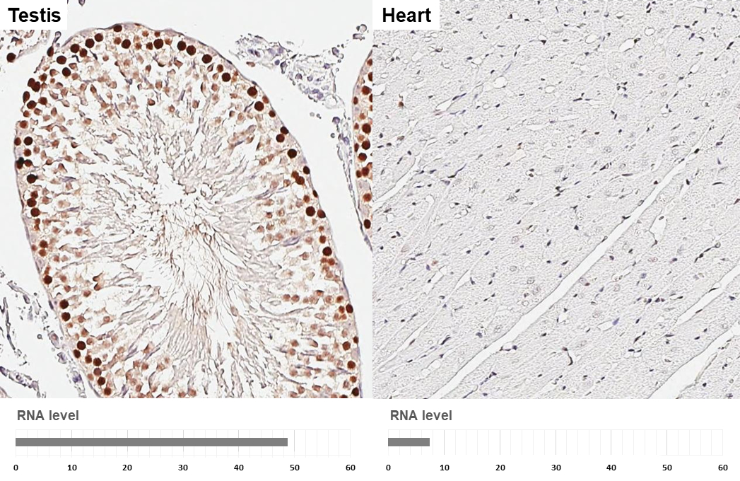PCNA antibody [HL1965] detects PCNA protein by immunohistochemical analysis. Sample: Paraffin-embedded rat tissues. PCNA stained by PCNA antibody [HL1965] (GTX637858) diluted at 1:15000. Antigen Retrieval: Citrate buffer, pH 6.0, 15 min