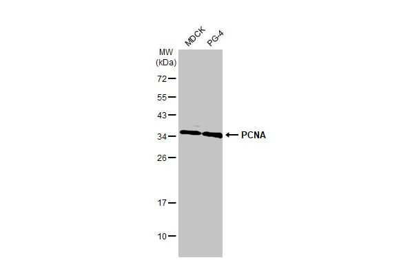 Various whole cell extracts (30 μg) were separated by 12% SDS-PAGE, and the membrane was blotted with PCNA antibody [HL1965] (GTX637858) diluted at 1:1000. The HRP-conjugated anti-rabbit IgG antibody (GTX213110-01) was used to detect the primary antibody.