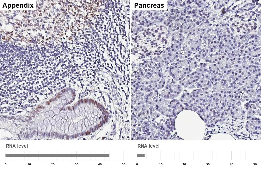 PCNA antibody [HL1966] detects PCNA protein by immunohistochemical analysis. Sample: Paraffin-embedded human tissues. PCNA stained by PCNA antibody [HL1966] (GTX637859) diluted at 1:200000. Antigen Retrieval: Citrate buffer, pH 6.0, 15 min
