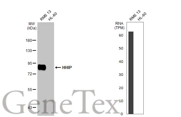 Various whole cell extracts (30 μg) were separated by 7.5% SDS-PAGE, and the membrane was blotted with HHIP antibody [HL1969] (GTX637862) diluted at 1:1000. The HRP-conjugated anti-rabbit IgG antibody (GTX213110-01) was used to detect the primary antibody, and the signal was developed with Trident ECL plus-Enhanced. Corresponding RNA expression data for the same cell lines are based on Human Protein Atlas program.