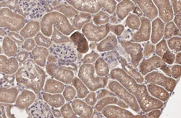 HHIP antibody [HL1969] detects HHIP protein at cell membrane and secreted by immunohistochemical analysis. Sample: Paraffin-embedded mouse kidney. HHIP stained by HHIP antibody [HL1969] (GTX637862) diluted at 1:100. Antigen Retrieval: Citrate buffer, pH 6.0, 15 min