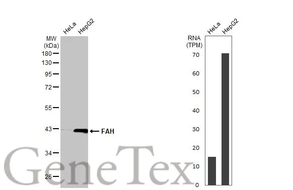 Various whole cell extracts (30 μg) were separated by 10% SDS-PAGE, and the membrane was blotted with FAH antibody [HL1970] (GTX637863) diluted at 1:1000. The HRP-conjugated anti-rabbit IgG antibody (GTX213110-01) was used to detect the primary antibody. Corresponding RNA expression data for the same cell lines are based on Human Protein Atlas program.