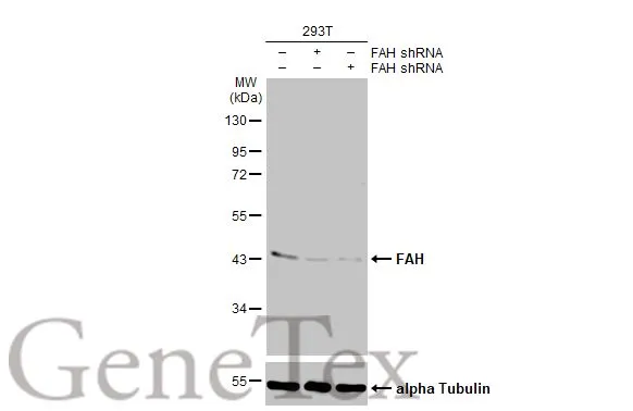 Non-transfected (–) and transfected (+) 293T whole cell extracts (30 μg) were separated by 10% SDS-PAGE, and the membrane was blotted with FAH antibody [HL1970] (GTX637863) diluted at 1:1000. The HRP-conjugated anti-rabbit IgG antibody (GTX213110-01) was used to detect the primary antibody.