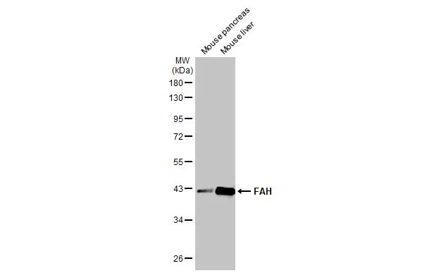 Various tissue extracts (50 μg) were separated by 10% SDS-PAGE, and the membrane was blotted with FAH antibody [HL1970] (GTX637863) diluted at 1:1000. The HRP-conjugated anti-rabbit IgG antibody (GTX213110-01) was used to detect the primary antibody.