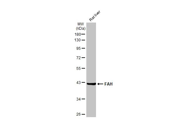 Rat tissue extract (50 μg) was separated by 10% SDS-PAGE, and the membrane was blotted with FAH antibody [HL1970] (GTX637863) diluted at 1:1000. The HRP-conjugated anti-rabbit IgG antibody (GTX213110-01) was used to detect the primary antibody.