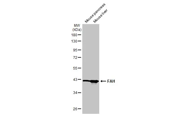 Various tissue extracts (50 μg) were separated by 10% SDS-PAGE, and the membrane was blotted with FAH antibody [HL1972] (GTX637865) diluted at 1:1000. The HRP-conjugated anti-rabbit IgG antibody (GTX213110-01) was used to detect the primary antibody.