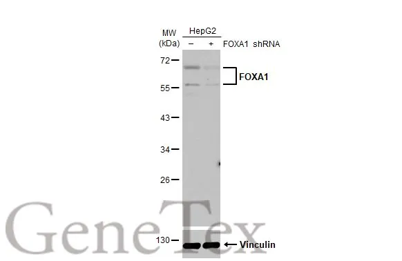 Non-transfected (–) and transfected (+) HepG2 whole cell extracts (30 μg) were separated by 10% SDS-PAGE, and the membrane was blotted with FOXA1 antibody [HL1974] (GTX637867) diluted at 1:1000. The HRP-conjugated anti-rabbit IgG antibody (GTX213110-01) was used to detect the primary antibody.