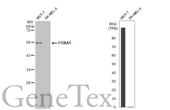 FOXA1 antibody [HL1975]