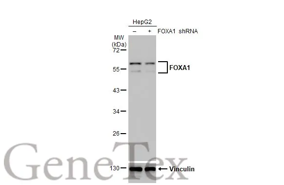 FOXA1 antibody [HL1975]