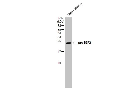Mouse plasma (30 μg) was separated by 15% SDS-PAGE, and the membrane was blotted with IGF2 antibody [HL1982] (GTX637875) diluted at 1:1000. The HRP-conjugated anti-rabbit IgG antibody (GTX213110-01) was used to detect the primary antibody.