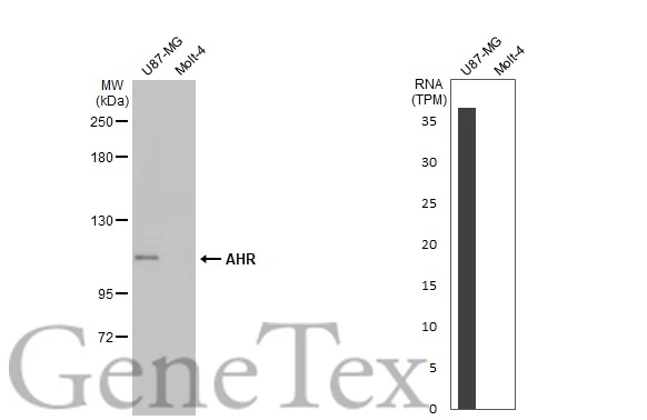 Various whole cell extracts (30 μg) were separated by 5% SDS-PAGE, and the membrane was blotted with AHR antibody [HL1984] (GTX637885) diluted at 1:1000. The HRP-conjugated anti-rabbit IgG antibody (GTX213110-01) was used to detect the primary antibody. Corresponding RNA expression data for the same cell lines are based on Human Protein Atlas program.