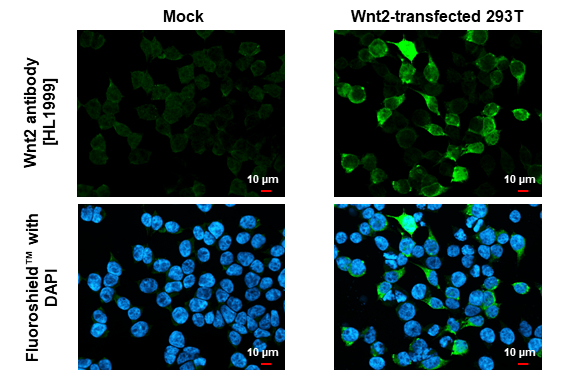 Wnt2 antibody [HL1999] detects Wnt2 protein by immunofluorescent analysis. Sample: Mock and transfected 293T cells were fixed in 4% paraformaldehyde at RT for 15 min. Green: Wnt2 stained by Wnt2 antibody [HL1999] (GTX637900) diluted at 1:500. Blue: Fluoroshield with DAPI (GTX30920).