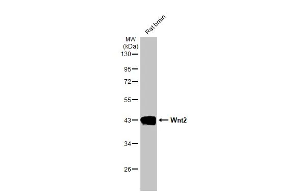 Rat tissue extract (50 μg) was separated by 10% SDS-PAGE, and the membrane was blotted with Wnt2 antibody [HL1999] (GTX637900) diluted at 1:1000. The HRP-conjugated anti-rabbit IgG antibody (GTX213110-01) was used to detect the primary antibody.