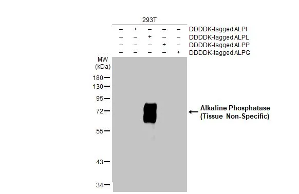 Non-transfected (–) and transfected (+) 293T whole cell extracts (30 μg) were separated by 10% SDS-PAGE, and the membrane was blotted with Alkaline Phosphatase (Tissue Non-Specific) antibody [HL2003] (GTX637904) diluted at 1:1000. The HRP-conjugated anti-rabbit IgG antibody (GTX213110-01) was used to detect the primary antibody.