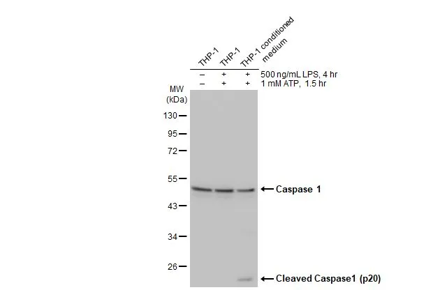 Untreated (–) and treated (+) THP-1 whole cell extract (30 μg) were separated by 10% SDS-PAGE, and the membrane was blotted with Caspase 1 antibody [HL2005] (GTX637906) diluted at 1:1000. The HRP-conjugated anti-rabbit IgG antibody (GTX213110-01) was used to detect the primary antibody.