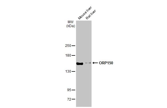 Various tissue extracts (50 μg) were separated by 5% SDS-PAGE, and the membrane was blotted with ORP150 antibody [HL2006] (GTX637907) diluted at 1:1000. The HRP-conjugated anti-rabbit IgG antibody (GTX213110-01) was used to detect the primary antibody, and the signal was developed with Trident ECL plus-Enhanced.