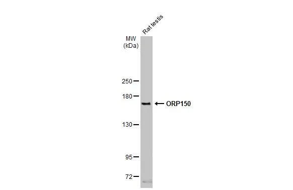 Rat tissue extract (50 μg) was separated by 5% SDS-PAGE, and the membrane was blotted with ORP150 antibody [HL2006] (GTX637907) diluted at 1:1000. The HRP-conjugated anti-rabbit IgG antibody (GTX213110-01) was used to detect the primary antibody, and the signal was developed with Trident femto Western HRP Substrate.