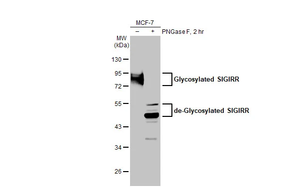 SIGIRR antibody [HL2007]