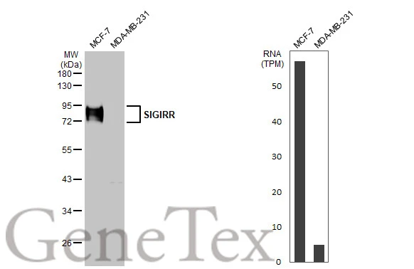 SIGIRR antibody [HL2008]