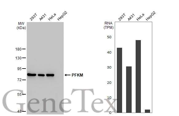 PFKM antibody [HL2010]