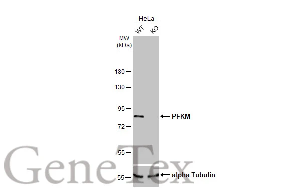 PFKM antibody [HL2010]