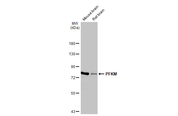 PFKM antibody [HL2010]
