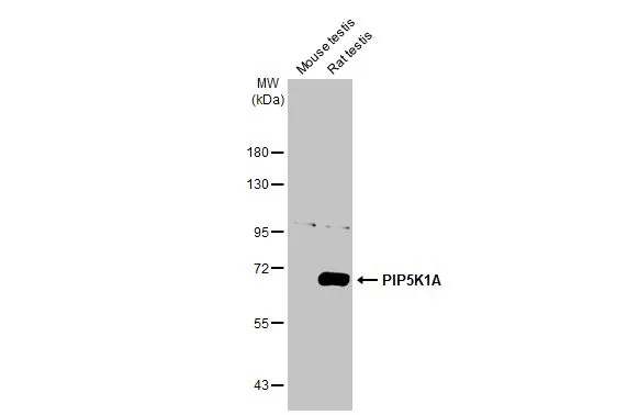 Various tissue extracts (50 μg) were separated by 7.5% SDS-PAGE, and the membrane was blotted with PIP5K1A antibody [HL2011] (GTX637912) diluted at 1:1000. The HRP-conjugated anti-rabbit IgG antibody (GTX213110-01) was used to detect the primary antibody.