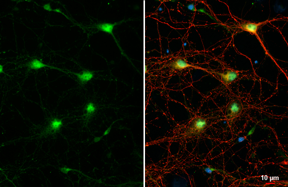 Choline Acetyltransferase antibody [HL2014] detects Choline Acetyltransferase protein at cytoplasm by immunofluorescent analysis. Sample: DIV9 rat E18 primary cortical neuron and glia cells were fixed in 4% paraformaldehyde at RT for 15 min. Green: Choline Acetyltransferase stained by Choline Acetyltransferase antibody [HL2014] (GTX637915) diluted at 1:250. Red: Tau, an Axon marker, stained by Tau antibody [GT287] (GTX634809) diluted at 1:500. Blue: Fluoroshield with DAPI (GTX30920).