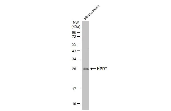 Mouse tissue extract (50 μg) was separated by 12% SDS-PAGE, and the membrane was blotted with HPRT antibody [HL2015] (GTX637916) diluted at 1:5000. The HRP-conjugated anti-rabbit IgG antibody (GTX213110-01) was used to detect the primary antibody.