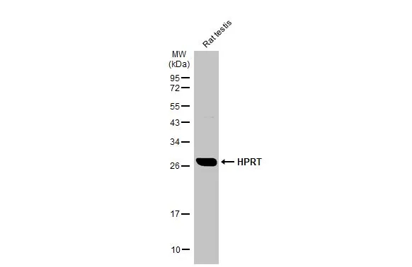 Rat tissue extract (50 μg) was separated by 12% SDS-PAGE, and the membrane was blotted with HPRT antibody [HL2015] (GTX637916) diluted at 1:5000. The HRP-conjugated anti-rabbit IgG antibody (GTX213110-01) was used to detect the primary antibody.