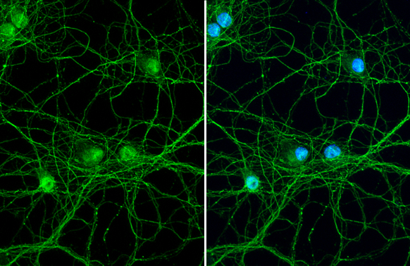 HPRT antibody [HL2015] detects HPRT protein at cell membrane by immunofluorescent analysis. Sample: DIV9 rat E18 primary hippocampal neuron cells were fixed in 4% paraformaldehyde at RT for 15 min. Green: HPRT stained by HPRT antibody [HL2015] (GTX637916) diluted at 1:250. Blue: Fluoroshield with DAPI (GTX30920).