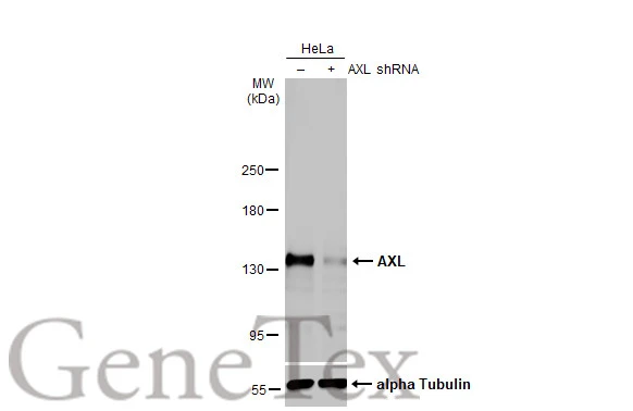 Non-transfected (–) and transfected (+) HeLa whole cell extracts (30 μg) were separated by 5% SDS-PAGE, and the membrane was blotted with AXL antibody [HL2021] (GTX637922) diluted at 1:1000. The HRP-conjugated anti-rabbit IgG antibody (GTX213110-01) was used to detect the primary antibody, and the signal was developed with Trident ECL plus-Enhanced.
