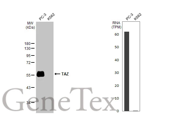 Various whole cell extracts (30 μg) were separated by 10% SDS-PAGE, and the membrane was blotted with TAZ antibody [HL2032] (GTX637933) diluted at 1:1000. The HRP-conjugated anti-rabbit IgG antibody (GTX213110-01) was used to detect the primary antibody. Corresponding RNA expression data for the same cell lines are based on Human Protein Atlas program.
