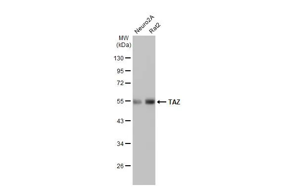 Various whole cell extracts (30 μg) were separated by 10% SDS-PAGE, and the membrane was blotted with TAZ antibody [HL2032] (GTX637933) diluted at 1:1000. The HRP-conjugated anti-rabbit IgG antibody (GTX213110-01) was used to detect the primary antibody.