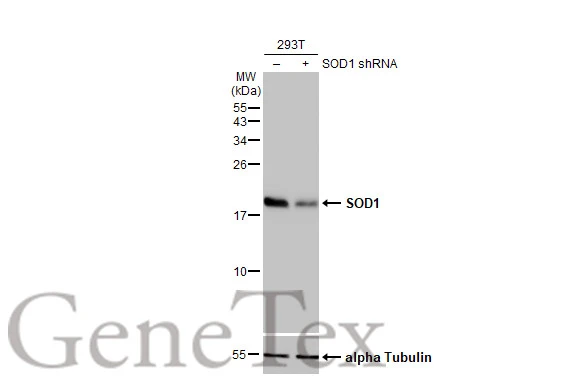 Non-transfected (–) and transfected (+) 293T whole cell extracts (30 μg) were separated by 15% SDS-PAGE, and the membrane was blotted with SOD1 antibody [HL2033] (GTX637934) diluted at 1:30000. The HRP-conjugated anti-rabbit IgG antibody (GTX213110-01) was used to detect the primary antibody.