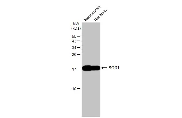 Various tissue extracts (50 μg) were separated by 15% SDS-PAGE, and the membrane was blotted with SOD1 antibody [HL2033] (GTX637934) diluted at 1:1000. The HRP-conjugated anti-rabbit IgG antibody (GTX213110-01) was used to detect the primary antibody.