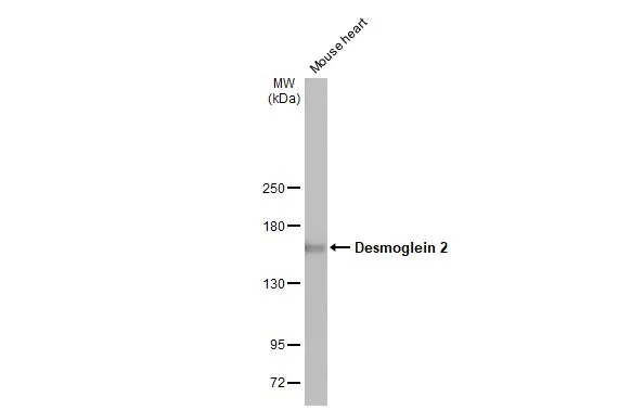 Mouse tissue extract (50 μg) was separated by 5% SDS-PAGE, and the membrane was blotted with Desmoglein 2 antibody [HL2036] (GTX637937) diluted at 1:1000. The HRP-conjugated anti-rabbit IgG antibody (GTX213110-01) was used to detect the primary antibody.