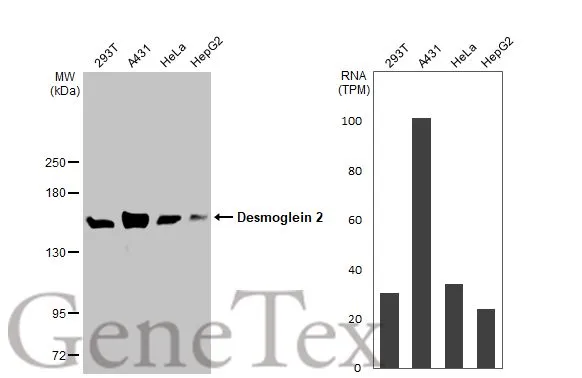 Various whole cell extracts (30 μg) were separated by 5% SDS-PAGE, and the membrane was blotted with Desmoglein 2 antibody [HL2036] (GTX637937) diluted at 1:5000. The HRP-conjugated anti-rabbit IgG antibody (GTX213110-01) was used to detect the primary antibody. Corresponding RNA expression data for the same cell lines are based on Human Protein Atlas program.