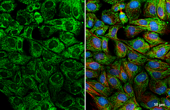 Bcl-XL antibody [HL2038] detects Bcl-XL protein by immunofluorescent analysis. Sample: MDCK cells were fixed in ice-cold MeOH for 5 min. Green: Bcl-XL stained by Bcl-XL antibody [HL2038] (GTX637939) diluted at 1:500. Red: alpha Tubulin, a cytoskeleton marker, stained by alpha Tubulin antibody [GT114] (GTX628802) diluted at 1:1000. Blue: Fluoroshield with DAPI (GTX30920).