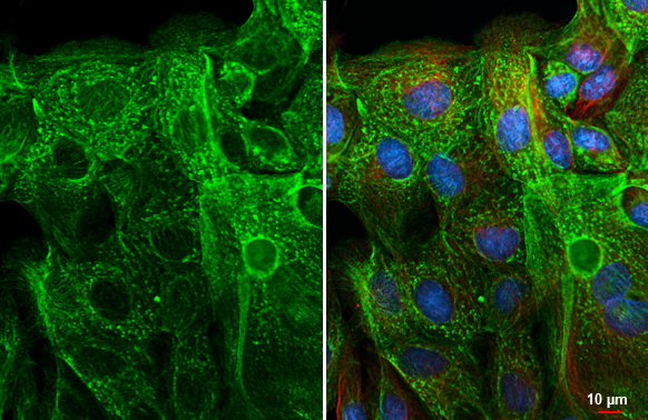 Bcl-XL antibody [HL2039] detects Bcl-XL protein by immunofluorescent analysis. Sample: MDCK cells were fixed in ice-cold MeOH for 5 min. Green: Bcl-XL stained by Bcl-XL antibody [HL2039] (GTX637940) diluted at 1:500. Red: alpha Tubulin, a cytoskeleton marker, stained by alpha Tubulin antibody [GT114] (GTX628802) diluted at 1:1000. Blue: Fluoroshield with DAPI (GTX30920).