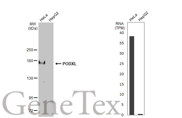 Various whole cell extracts (30 μg) were separated by 5% SDS-PAGE, and the membrane was blotted with PODXL antibody [HL2047] (GTX637951) diluted at 1:1000. The HRP-conjugated anti-rabbit IgG antibody (GTX213110-01) was used to detect the primary antibody. Corresponding RNA expression data for the same cell lines are based on Human Protein Atlas program.
