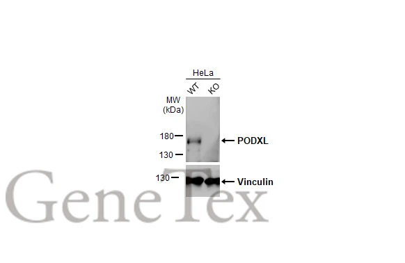 Wild-type (WT) and PODXL knockout (KO) HeLa cell extracts (5 μg) were separated by 7.5% SDS-PAGE, and the membrane was blotted with PODXL antibody [HL2047] (GTX637951) diluted at 1:500. The HRP-conjugated anti-rabbit IgG antibody (GTX213110-01) was used to detect the primary antibody, and the signal was developed with Trident ECL plus-Enhanced.