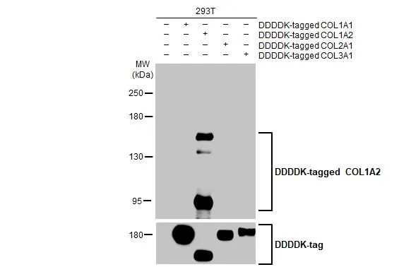 Non-transfected (–) and transfected (+) 293T whole cell extracts were separated by 5% SDS-PAGE, and the membrane was blotted with COL1A2 antibody [HL2048] (GTX637952) diluted at 1:5000. The HRP-conjugated anti-rabbit IgG antibody (GTX213110-01) was used to detect the primary antibody.