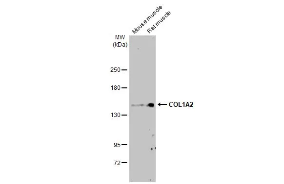 Various tissue extracts (50 μg) were separated by 5% SDS-PAGE, and the membrane was blotted with COL1A2 antibody [HL2049] (GTX637953) diluted at 1:1000. The HRP-conjugated anti-rabbit IgG antibody (GTX213110-01) was used to detect the primary antibody, and the signal was developed with Trident ECL plus-Enhanced.
